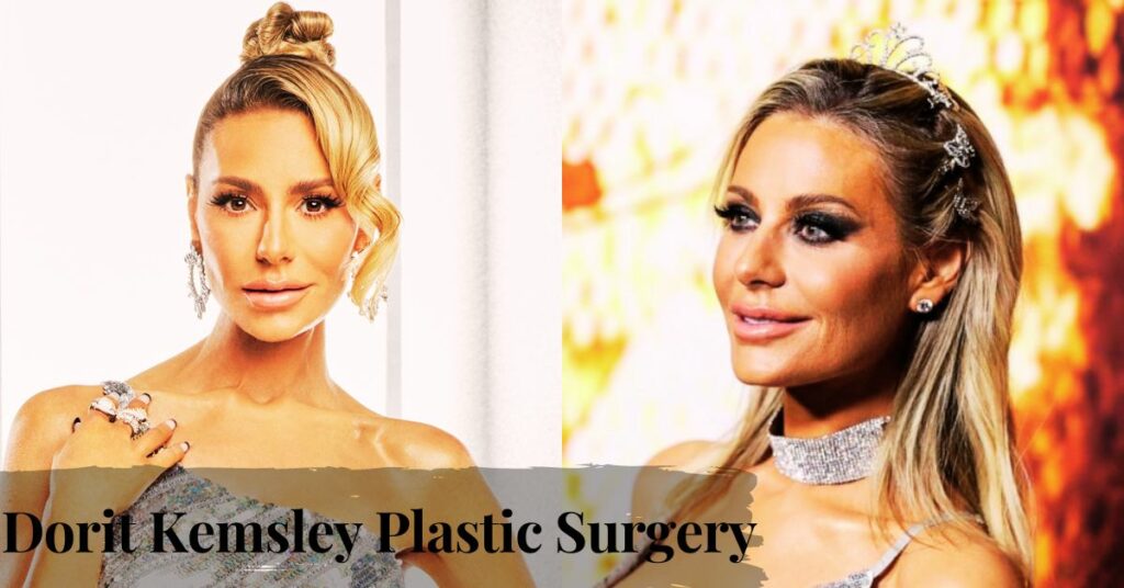 Dorit Kemsley Plastic Surgery