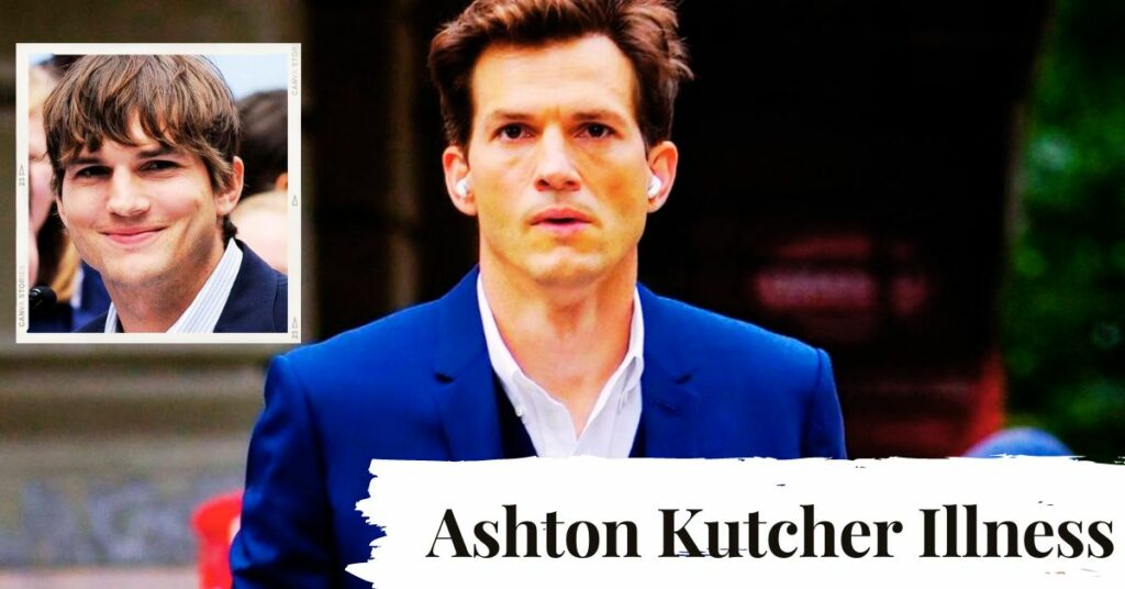 Ashton Kutcher Illness